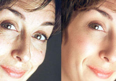 retouch a picture of you making it more appealing big2