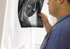 send you a picture of doctor holding your xray film small3