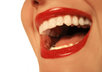Big_mouth_smile1218755919
