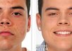 remove any blemish from any of your photos
