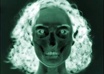 make an Xray image of you
