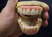 email you detailed instructions to make professional prosthetic teeth that do not require adhesive