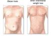 let u know how you can burn 5 kg in a week without a gym