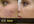 give you 575 PLR Articles on Acne