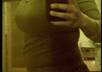 tell you about my experience as a lapband patient small1
