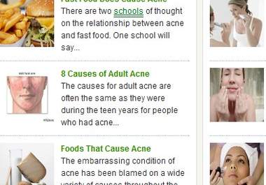 give You content for an acne website, plus ebooks to sell big1