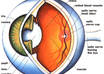 answer three questions about EYES or eye diseases in plain English within 48 hours small1